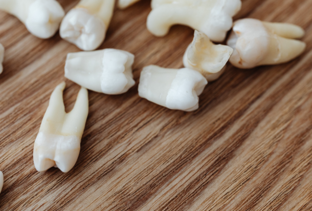 Manchas en los dientes: causas, tratamientos y cuándo preocuparse