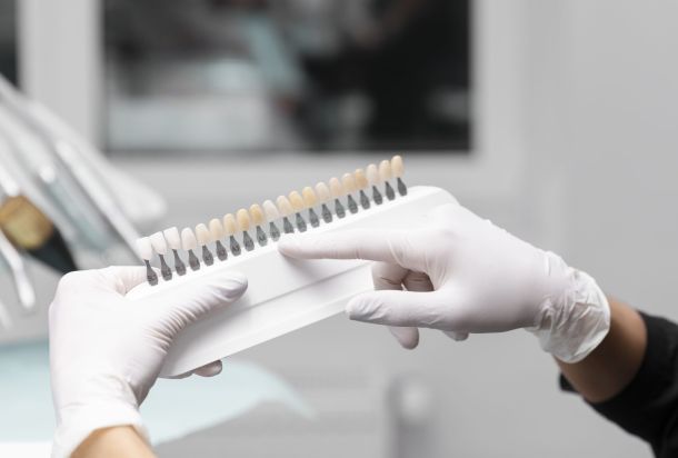 Blanqueamiento dental: en qué consiste, tipos y resultados reales