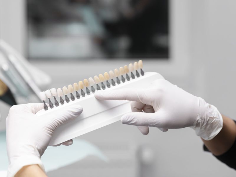 Blanqueamiento dental: en qué consiste, tipos y resultados reales