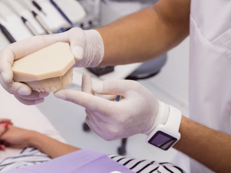 Qué es el autotrasplante dental y por qué puede ser mejor que un implante en ciertos casos