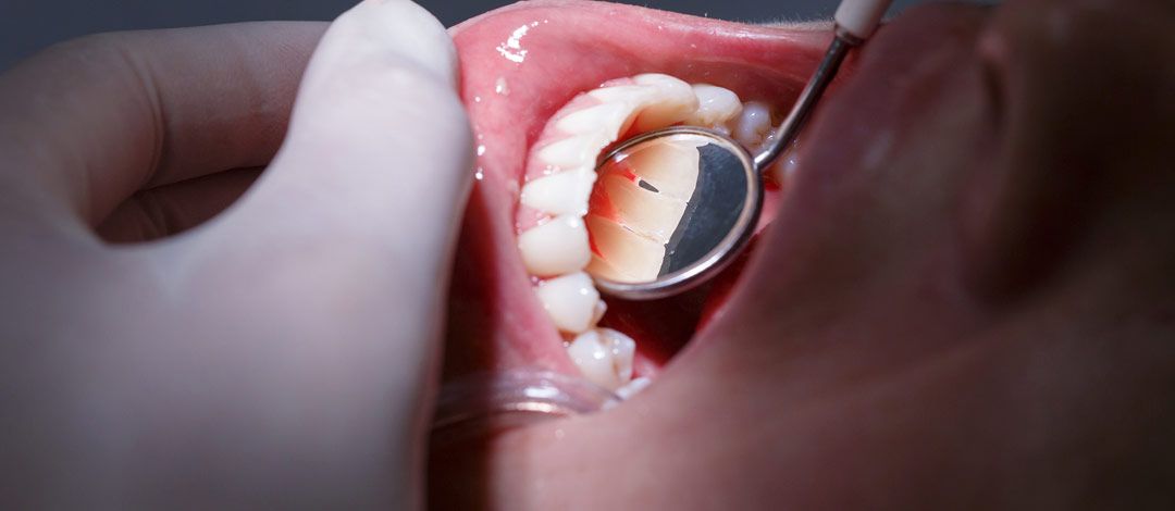 Periodoncia en Clínica Pastor